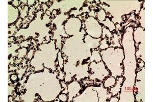 Immunohistochemical analysis of paraffin-embedded rat-lung, antibody was diluted at 1:100. (NRF2 antibody  (acLys599))