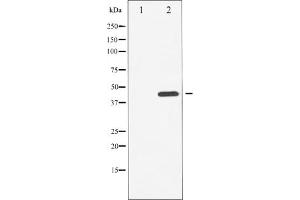Western blot analysis of Chk1 phosphorylation expression in UV treated HuvEc whole cell lysates,The lane on the left is treated with the antigen-specific peptide. (CHEK1 antibody  (pSer296))