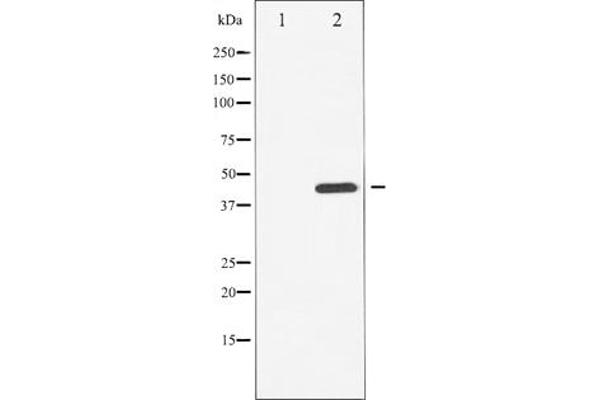 CHEK1 antibody  (pSer296)