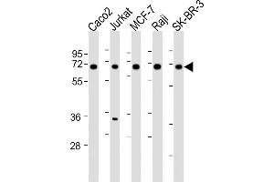 All lanes : Anti-P27 Antibody (Center) at 1:2000 dilution Lane 1: Caco2 whole cell lysates Lane 2: Jurkat whole cell lysates Lane 3: MCF-7 whole cell lysates Lane 4: Raji whole cell lysates Lane 5: SK-BR-3 whole cell lysates Lysates/proteins at 20 μg per lane. (MMP27 Antikörper  (AA 333-367))