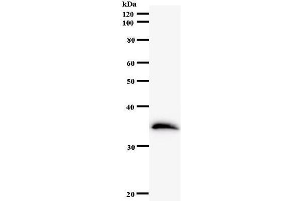 ETV3 antibody