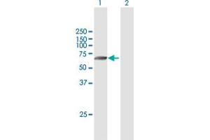 Western Blot analysis of TMPRSS6 expression in transfected 293T cell line by TMPRSS6 MaxPab polyclonal antibody. (TMPRSS6 antibody  (AA 1-461))