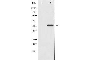 Western Blotting (WB) image for anti-Hepatocyte Nuclear Factor 4, alpha (HNF4A) (pSer313) antibody (ABIN3172529) (HNF4A antibody  (pSer313))