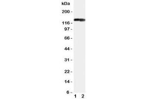 Western blot testing of COL2A1 antibody and Lane 1:  rat heart (COL2A1 antibody  (C-Term))