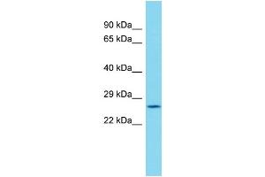 Host: Rabbit Target Name: C19orf52 Sample Type: Plancenta lysates Antibody Dilution: 1. (TIMM29 antibody  (C-Term))