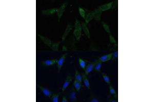 Immunofluorescence analysis of NIH-3T3 cells using ZWINT Polyclonal Antibody (ABIN6128944, ABIN6150552, ABIN6150554 and ABIN6221938) at dilution of 1:100 (40x lens). (ZWINT antibody  (AA 1-277))