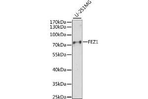 Western blot analysis of extracts of U-251MG cells, using FEZ1 antibody (ABIN7267140) at 1:1000 dilution. (FEZ1 antibody  (AA 1-160))