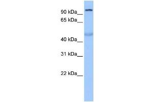 Western Blotting (WB) image for anti-Tubby Like Protein 3 (TULP3) antibody (ABIN2458310) (TULP3 antibody)