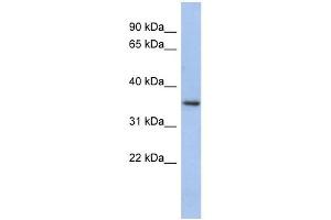 PEX7 antibody used at 1 ug/ml to detect target protein. (PEX7 antibody  (N-Term))