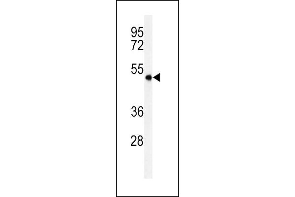 SMPDL3A antibody  (C-Term)