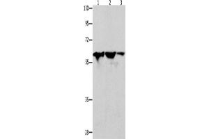 Western Blotting (WB) image for anti-DnaJ (Hsp40) Homolog, Subfamily C, Member 7 (DNAJC7) antibody (ABIN2428529) (DNAJC7 antibody)