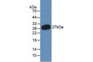 Detection of Recombinant PMP22, Human using Monoclonal Antibody to Peripheral Myelin Protein 22 (PMP22) (PMP22 antibody  (AA 31-133))