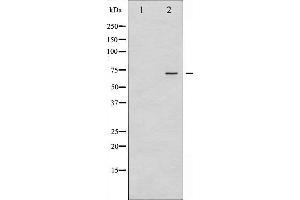 Western blot analysis of Estrogen Receptor- alpha phosphorylation expression in 293 whole cell lysates,The lane on the left is treated with the antigen-specific peptide. (Estrogen Receptor alpha antibody  (pTyr537))