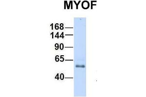 Host:  Rabbit  Target Name:  MYOF  Sample Type:  Human Fetal Heart  Antibody Dilution:  1. (Myoferlin antibody  (C-Term))