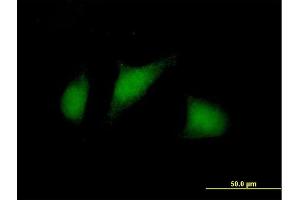 Immunofluorescence of purified MaxPab antibody to TSC22D1 on HeLa cell. (TSC22D1 antibody  (AA 1-144))