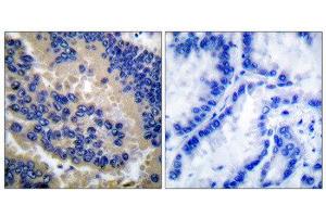 Immunohistochemistry (IHC) image for anti-Caspase 3 (CASP3) (Cleaved-Asp175) antibody (ABIN1853450) (Caspase 3 antibody  (Cleaved-Asp175))