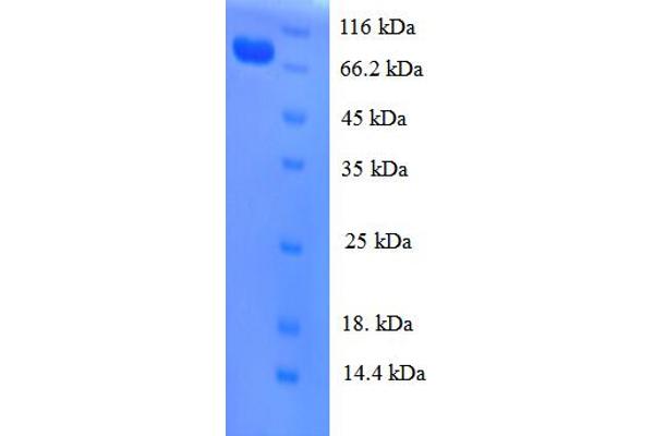 CDC23 Protein (AA 14-591, partial) (His tag)