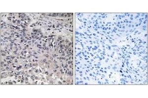 Immunohistochemistry (IHC) image for anti-Complement Component 1, Q Subcomponent, C Chain (C1QC) (AA 81-130) antibody (ABIN2890231) (C1QC antibody  (AA 81-130))