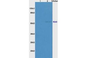 Lane 1: mouse embryo lysates Lane 2: rat brain lysates probed with Anti CK14/17/42/10 Polyclonal Antibody, Unconjugated (ABIN734498) at 1:200 in 4 °C. (pan Keratin antibody)