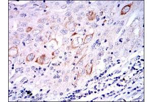 Immunohistochemistry (IHC) image for anti-Mitogen-Activated Protein Kinase Kinase 7 (MAP2K7) antibody (ABIN969271)