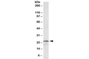 Western blot testing of K562 lysate with PSMB3 antibody at 1ug/ml. (PSMB3 antibody)