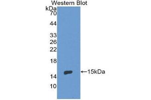 Western Blotting (WB) image for anti-Endoglin (ENG) (AA 336-450) antibody (ABIN3201550) (Endoglin antibody  (AA 336-450))