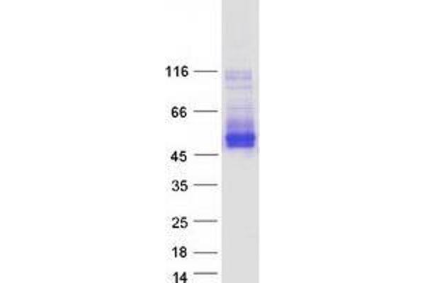 TMEM51 Protein (Transcript Variant 3) (Myc-DYKDDDDK Tag)