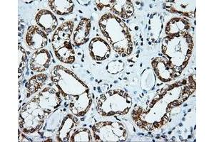 Immunohistochemistry (IHC) image for anti-Pleckstrin (PLEK) antibody (ABIN1500265) (Pleckstrin antibody)