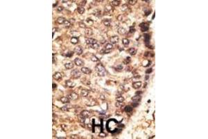 Immunohistochemistry (IHC) image for anti-Matrix Metallopeptidase 24 (Membrane-inserted) (MMP24) antibody (ABIN3002550) (MMP24 antibody)