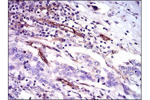 Immunohistochemistry (IHC) image for anti-CD59 (CD59) (AA 31-111) antibody (ABIN1098134)