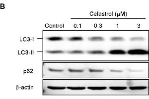 Western Blotting (WB) image for anti-Sequestosome 1 (SQSTM1) antibody (ABIN2854836)