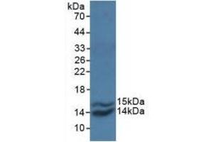 Detection of Recombinant MCP1, Simian using Polyclonal Antibody to Monocyte Chemotactic Protein 1 (MCP1) (CCL2 antibody  (AA 24-99))