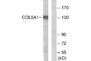 Immunohistochemistry analysis of paraffin-embedded human heart tissue using Collagen V α1 antibody. (COL5A1 antibody)
