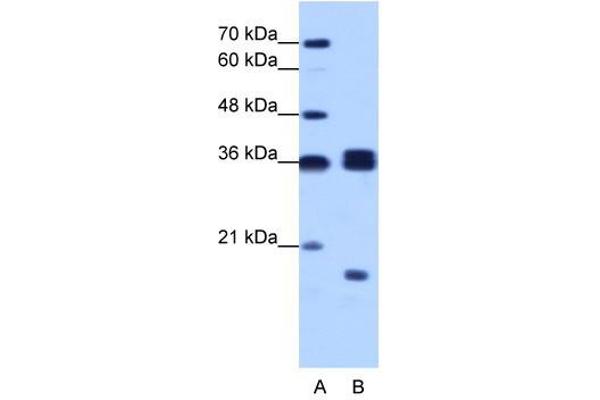 HNRNPH3 antibody