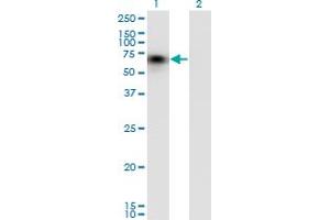 Western Blot analysis of CD44 expression in transfected 293T cell line by CD44 monoclonal antibody (M03), clone 1E1. (CD44 antibody  (AA 1-699))