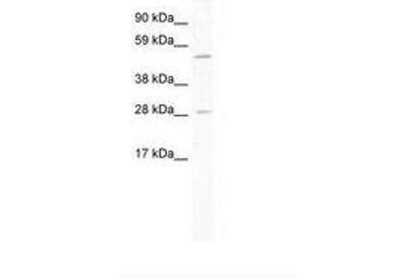 ASCL2 antibody  (AA 118-167)