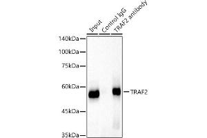 Immunoprecipitation analysis of 300 μg extracts of HeLa cells using 3 μg TR antibody . (TRAF2 antibody)