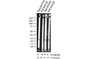 Western blot analysis of Phospho-Caveolin-1 (Tyr14) expression in various lysates (Caveolin-1 antibody  (pTyr14))