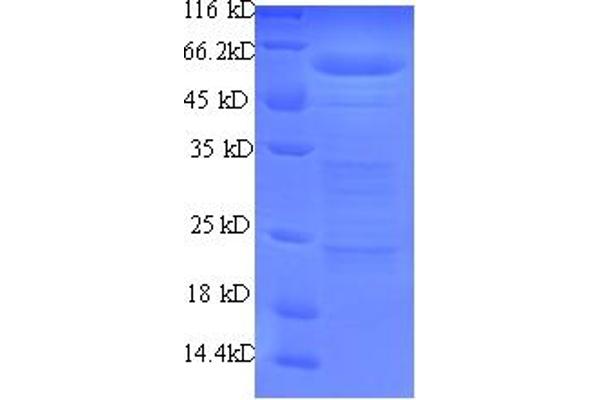 RBMY1A1 Protein (AA 1-459, partial) (His tag)