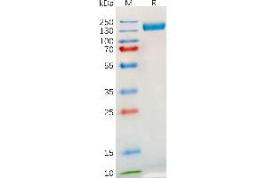 Human Protein, hFc Tag on SDS-PAGE under reducing condition. (TLR3 Protein (AA 28-80) (Fc Tag))