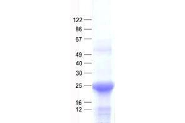 Splicing factor U2AF 26 kDa subunit (U2AF1L4) protein (His tag)