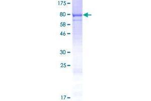 Image no. 1 for CWF19-Like 1, Cell Cycle Control (CWF19L1) (AA 1-538) protein (GST tag) (ABIN1350788) (CWF19L1 Protein (AA 1-538) (GST tag))