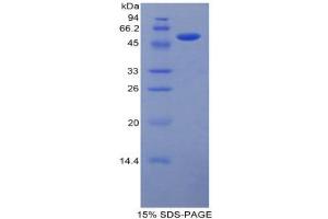 SDS-PAGE (SDS) image for Laminin, beta 1 (LAMB1) (AA 1053-1258) protein (His tag,GST tag) (ABIN2123144) (Laminin beta 1 Protein (AA 1053-1258) (His tag,GST tag))