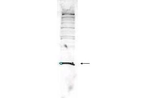 Western blot analysis is shown using  Affinity Purified anti-Human PARK7 antibody to detect PARK7 present in Jurkat whole cell lysate. (PARK7/DJ1 antibody  (AA 177-189))