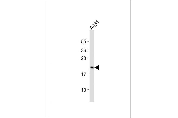 RAP2A antibody  (AA 124-159)