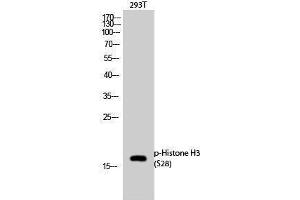 Western Blotting (WB) image for anti-Histone 3 (H3) (pSer28) antibody (ABIN3182029) (Histone 3 antibody  (pSer28))