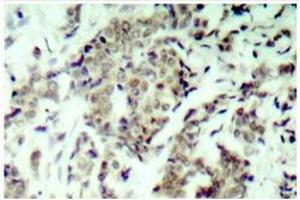 Image no. 2 for anti-Tumor Protein P53 (TP53) antibody (ABIN271765) (p53 antibody)