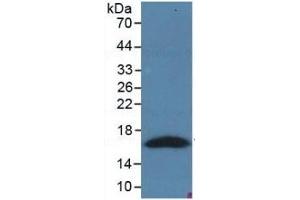 WB of Protein Standard: different control antibodies  against Highly purified E. (PRO-ANP ELISA Kit)