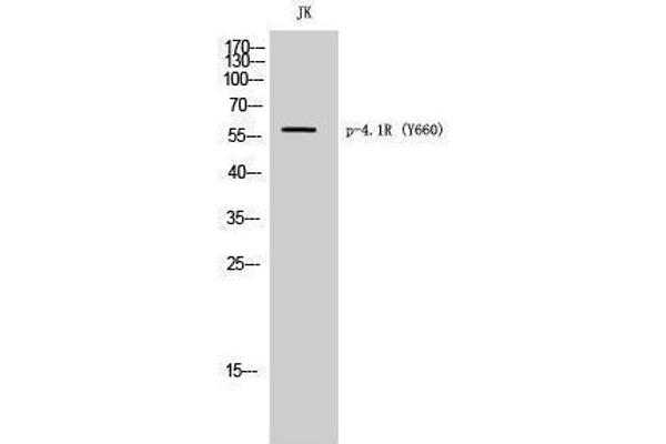 EPB41 antibody  (pTyr660)