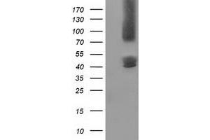 HEK293T cells were transfected with the pCMV6-ENTRY control (Left lane) or pCMV6-ENTRY GPHN (Right lane) cDNA for 48 hrs and lysed. (Gephyrin antibody)